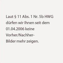 Brustverkleinerung einer Fettbrust - Fettabsaugung der Männerbrust