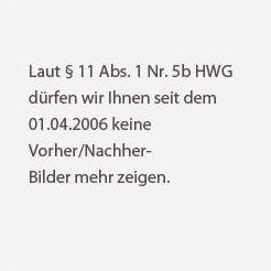 Vorher nachher Bilder von Liposuktion - Fettabsaugen Oberschenkel innen und außen, Reitehosen und Po